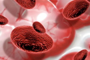 Remaja Putri Tampak Sehat, tetapi Terancam Anemia:   Ancaman Diam bagi Generasi Masa Depan