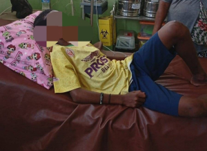 Sejumlah anak di Depapre diduga keracunan MBG